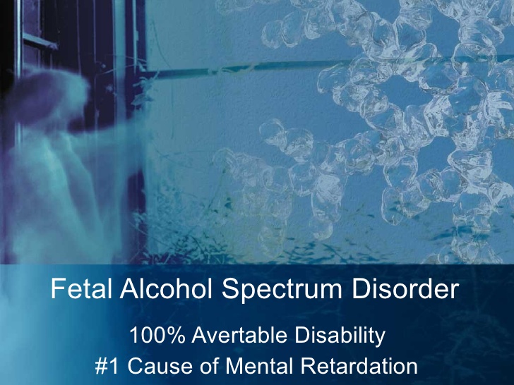 thesis statements for fetal alcohol syndrome thesis statements for fetal alcohol syndrome